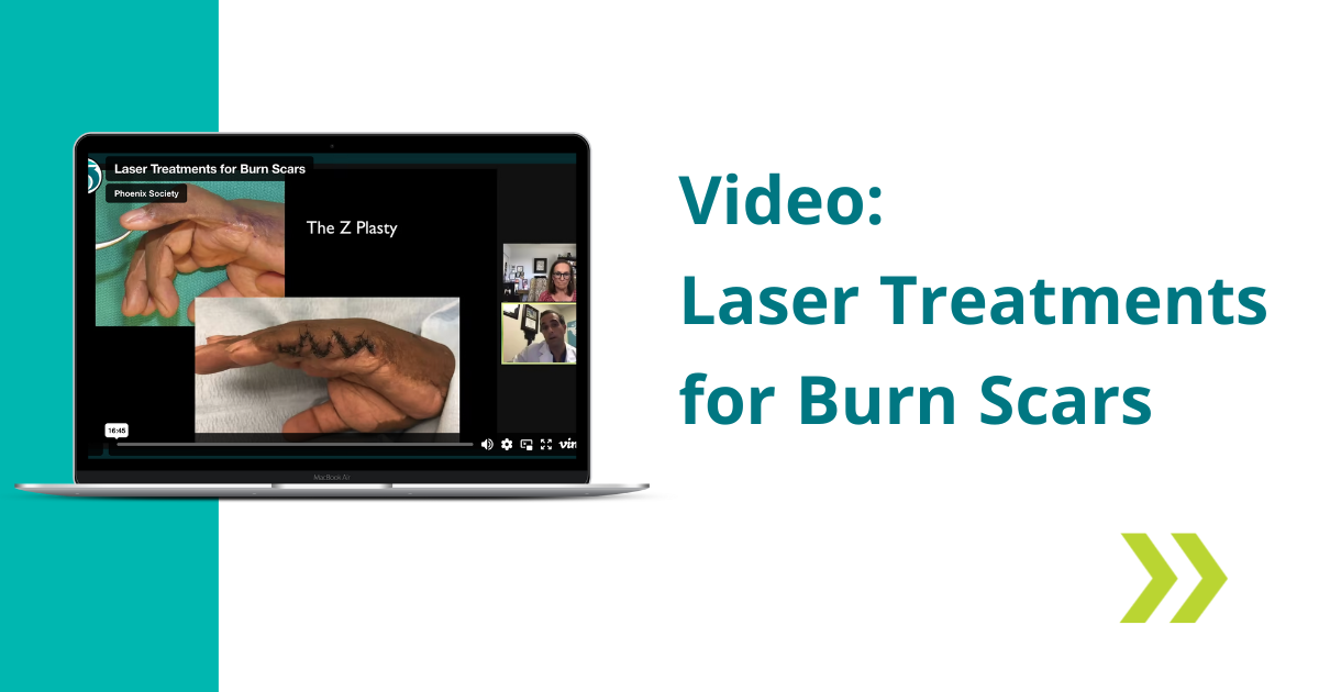 content.widgets.blog_listing_image.body.img.alt